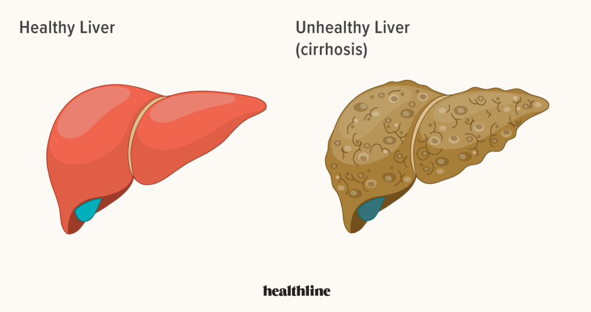 You are currently viewing Liver Diseases