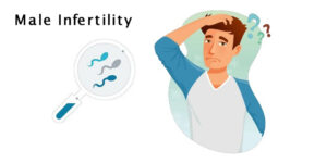Read more about the article Male infertility