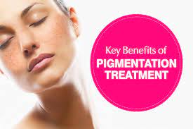 Read more about the article Pigmentation