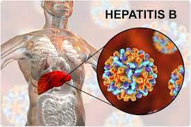 Read more about the article Hepatitis