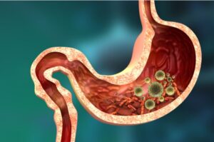 Read more about the article Stomach Diseases