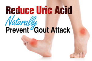 Read more about the article Uric Acid